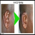 ear-bite-injury-repair4.jpg